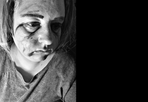 Ein Schwarz-Weiß-Foto einer Frau mit blauen Flecken im Gesicht, ernster Miene und konzentriertem Blick, die ein T-Shirt trägt und ihr Haar zurückgekämmt hat.